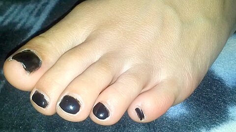 Macro Closeup Of Amateurs Black Toenails